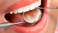 Obturación (empaste dental)